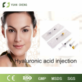 2017 Hot Sale Hyaluronic Acid Filler Removing Wrinkles